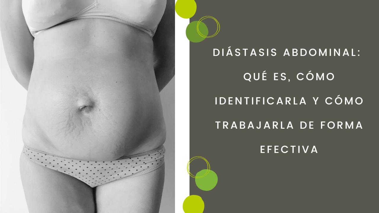 Diástasis abdominal: qué es, cómo identificarla y cómo trabajarla de forma efectiva